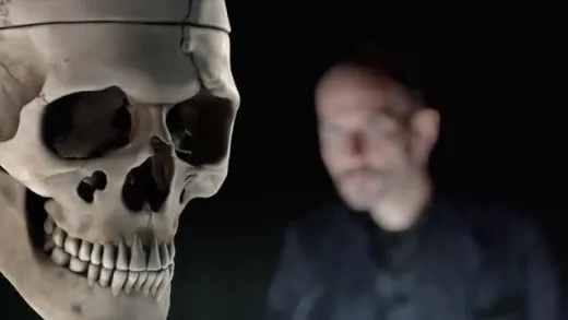 E2.Phineas Gage’s Skull