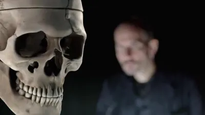 E2.Phineas Gage’s Skull
