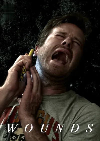 Wounds